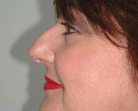Before Image: Patient # 21488 - 
