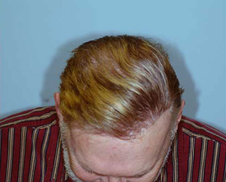 After Image: Patient # 75625 - 