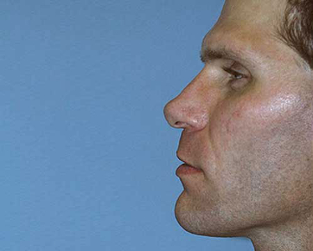 Before Image: Patient # 69195 - 