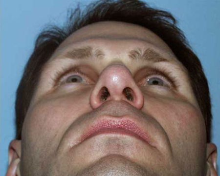 After Image: Patient # 69195 - 