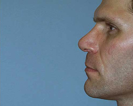 After Image: Patient # 69195 - 