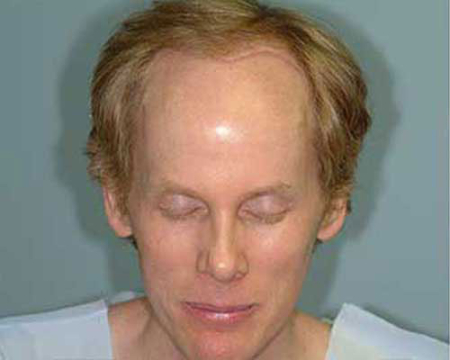 Before Image: Patient # 54834 - 