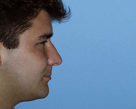 Before Image: Patient # 17926 - 