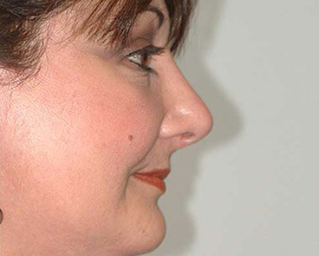 After Image: Patient # 21488 - 