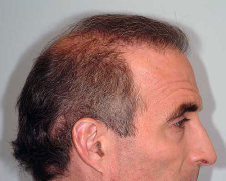 After Image: Patient # 80916 - 