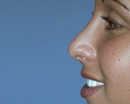 After Image: Patient # 50999 - 