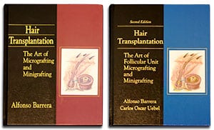 Hair Transplantation: The Art of Follicular Unit Micrografting and Minigrafting, Second Edition