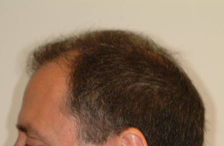 Before Image: Patient # 54947 - 