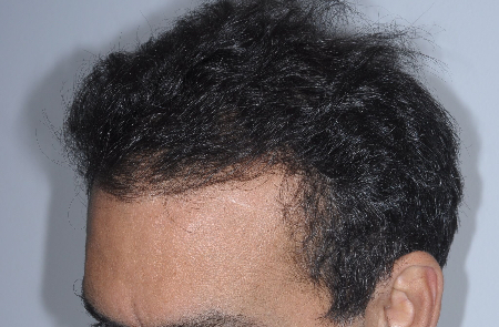 After Image: Patient # 86050 - 