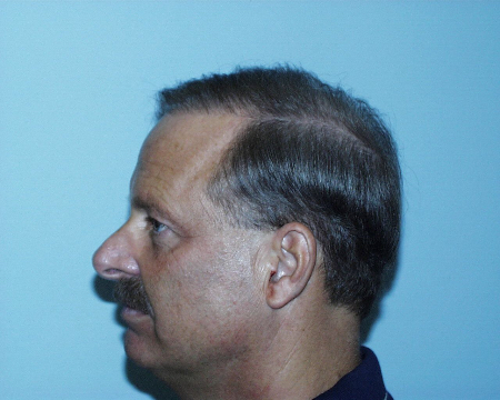 After Image: Patient # 30624 - 