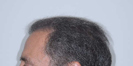 After Image: Patient # 54947 - 