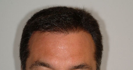 After Image: Patient # 99952 - 