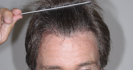 After Image: Patient # 50904 - 