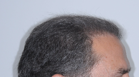 After Image: Patient # 54947 - 