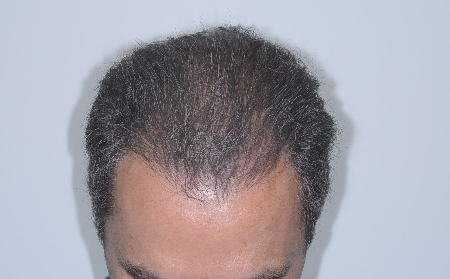 After Image: Patient # 54947 - 