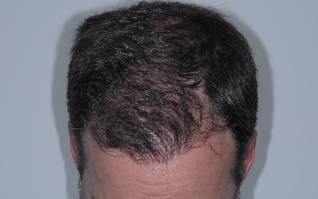 After Image: Patient # 80968 - 