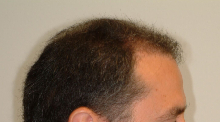 Before Image: Patient # 54947 - 