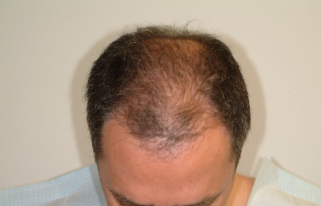Before Image: Patient # 54947 - 
