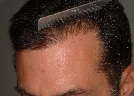 After Image: Patient # 99952 - 