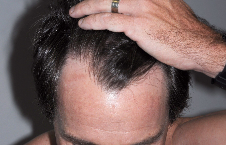 Before Image: Patient # 50904 - 