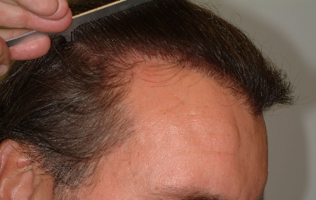 After Image: Patient # 29198 - 
