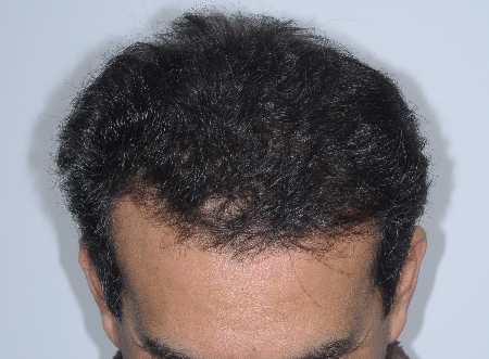 After Image: Patient # 86050 - 