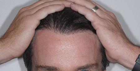 After Image: Patient # 50904 - 