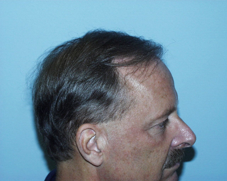 After Image: Patient # 30624 - 