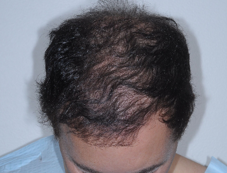After Image: Patient # 48126 - 