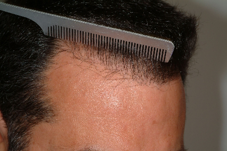 After Image: Patient # 99952 - 