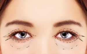 Eyelid Surgery | Alfonso Barrera, MD | Houston, TX