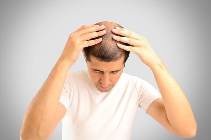 Hair loss