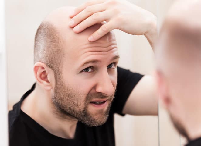 Hair Transplant