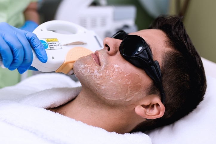 Just How Permanent is Laser Hair Removal? - Alfonso Barrera .