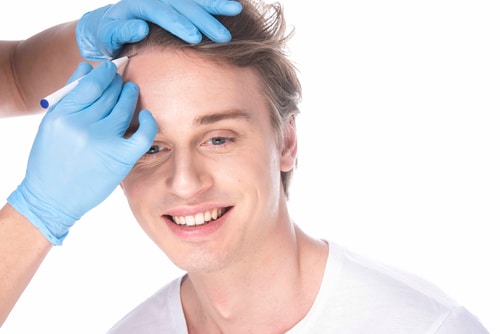 Man,With,Hair,Loss,Problem,Receiving,Injection,In,Head,,White