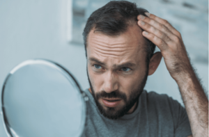 upset middle aged man with alopecia looking at mirror