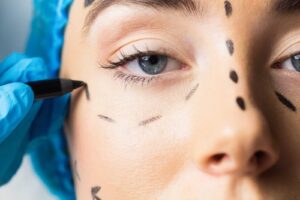 Peaceful young patient with dotted lines on the face in an examination room