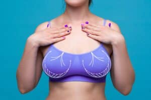 breast lift surgery