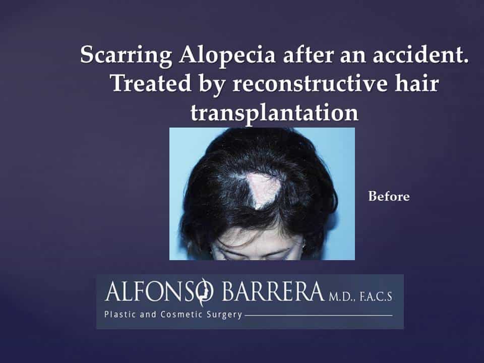 Slide117