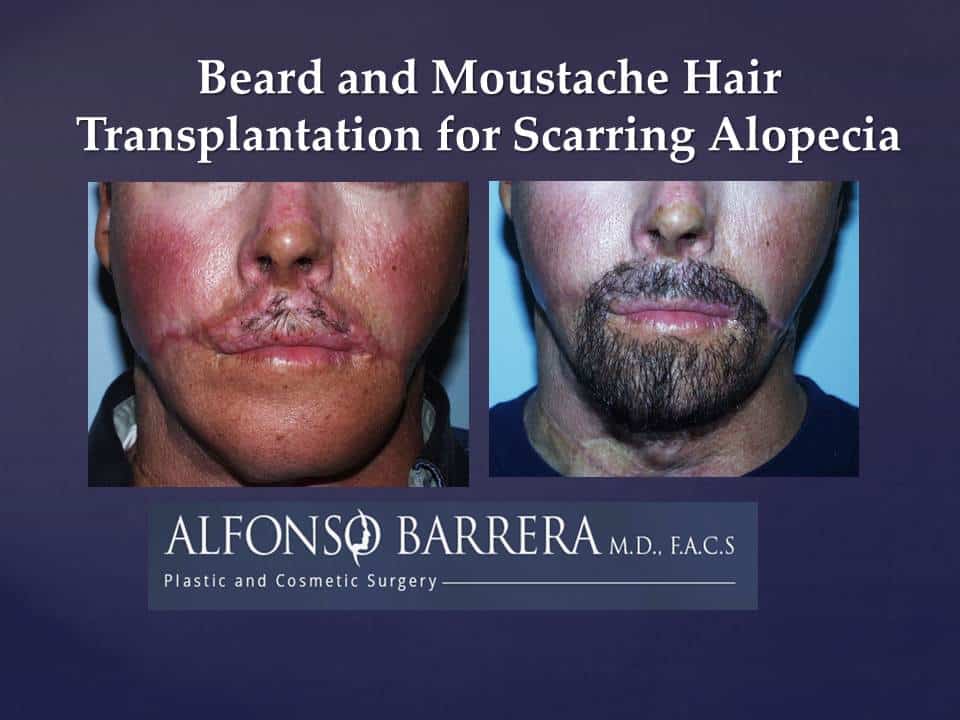 Slide132