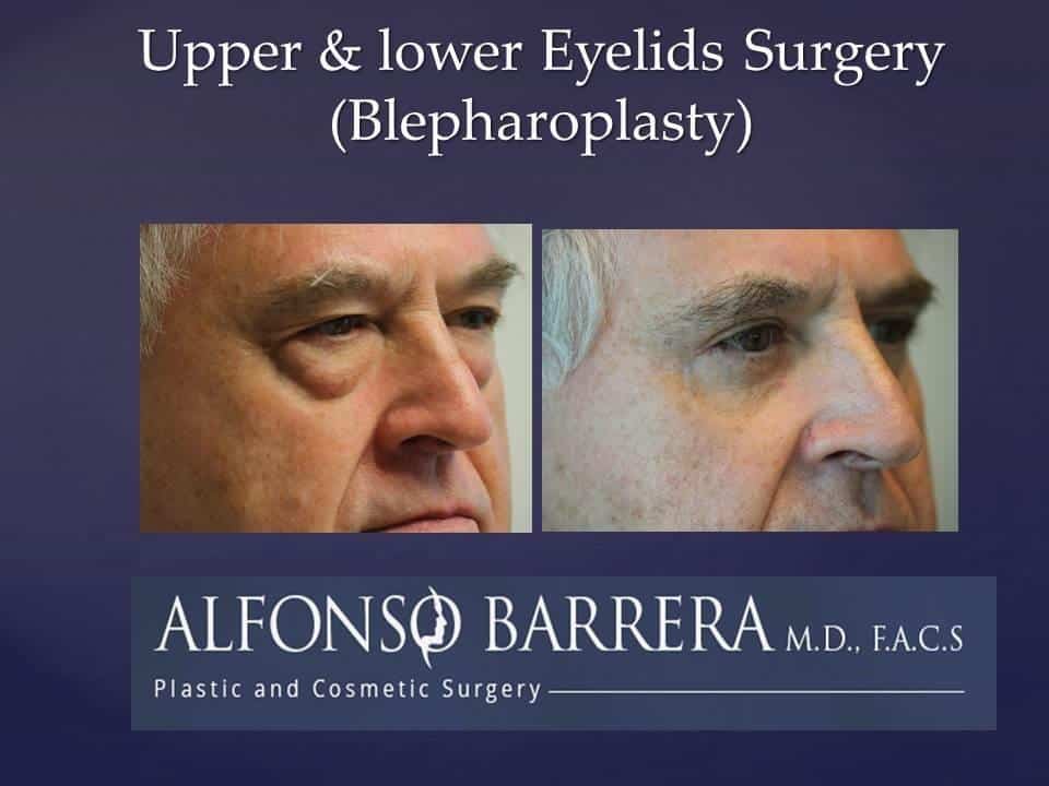 Slide151