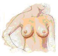 houston breast reduction 2
