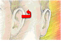 houston otoplasty 3