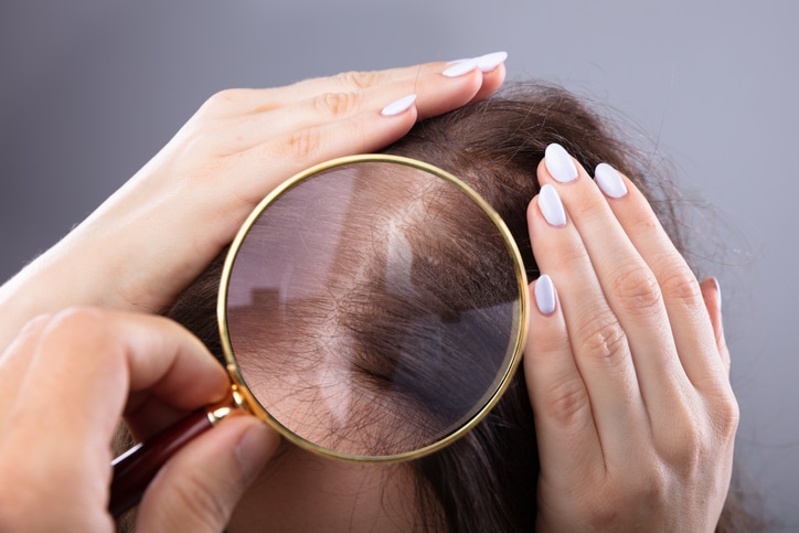 Female Hair Restoration Houston TX