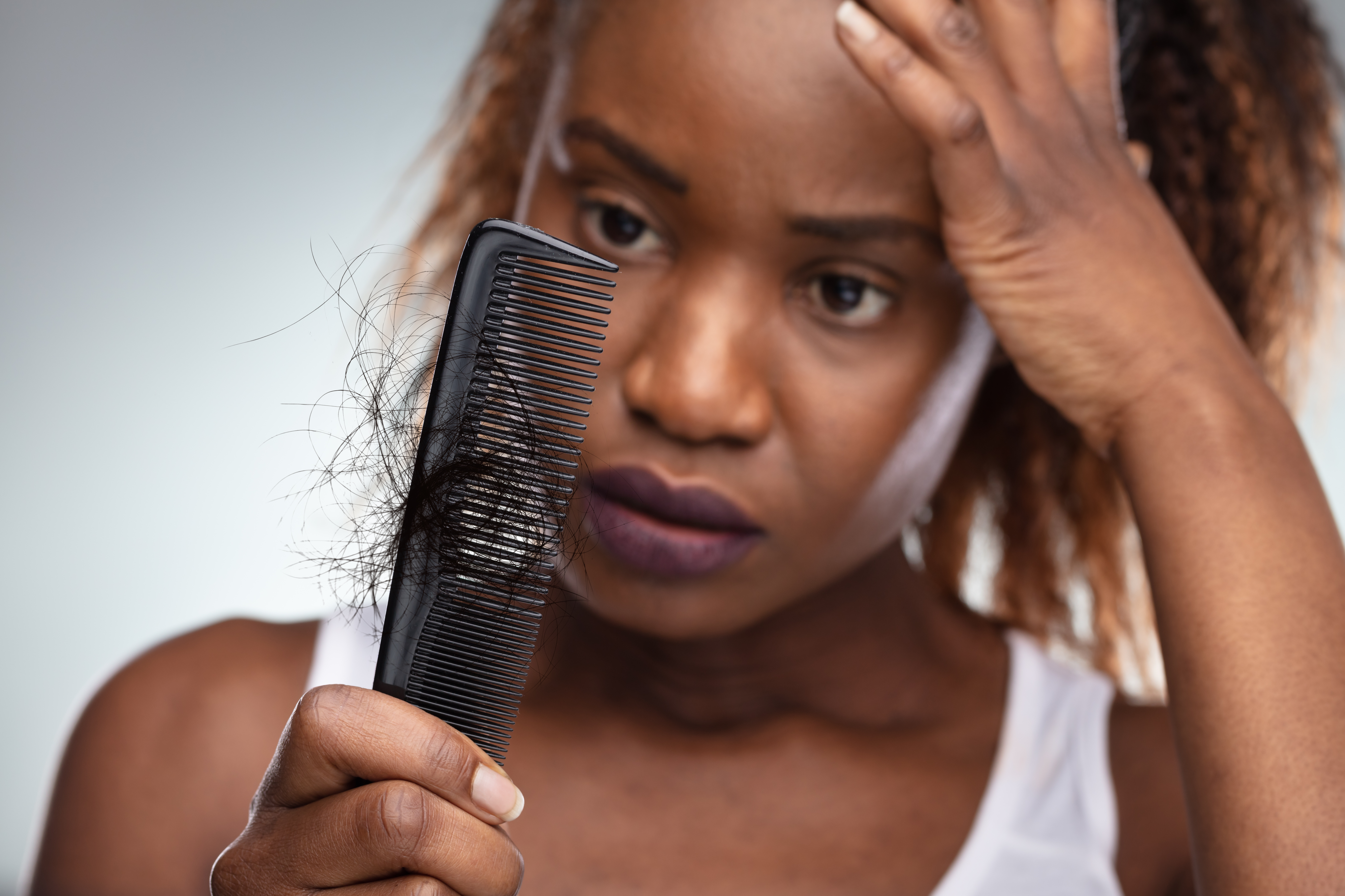 Woman in Houston, TX, with post-facelift hair loss