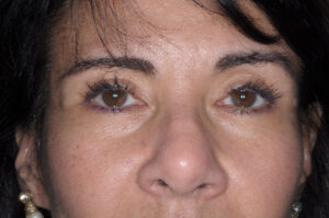After Image: Patient # 42560