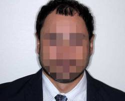 After Image: Patient # 20601 - front