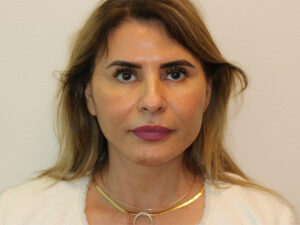 After Image: Patient # 43976