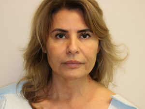 Before Image: Patient # 43976
