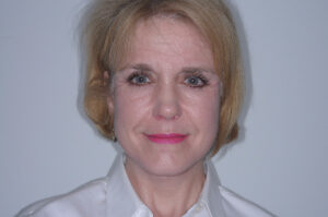 After Image: Patient # 59150